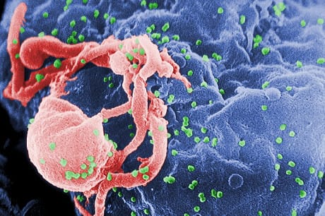Come uccidere l'HIV colpendo i suoi 