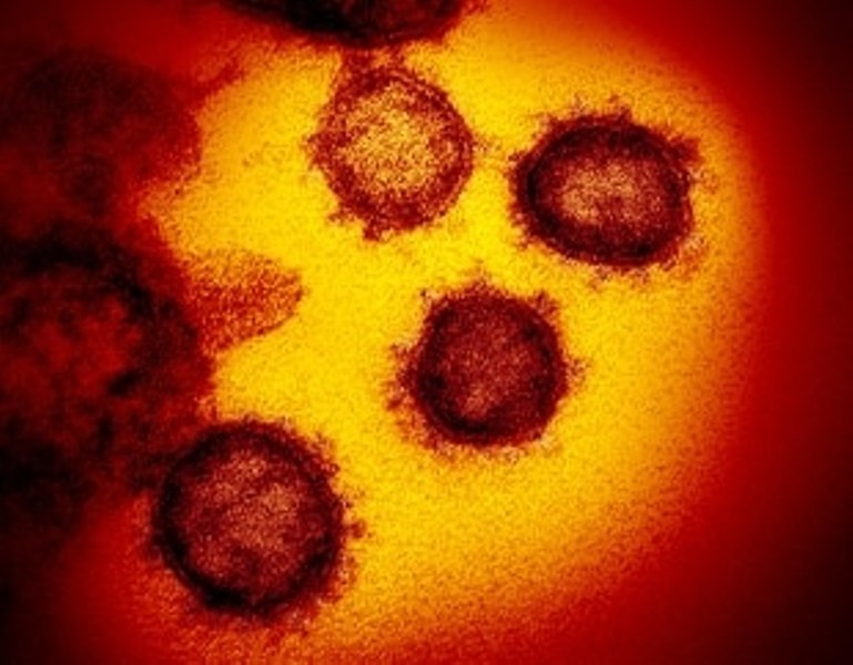 Coronavirus: mappa genetica, sono 3 i virus ...